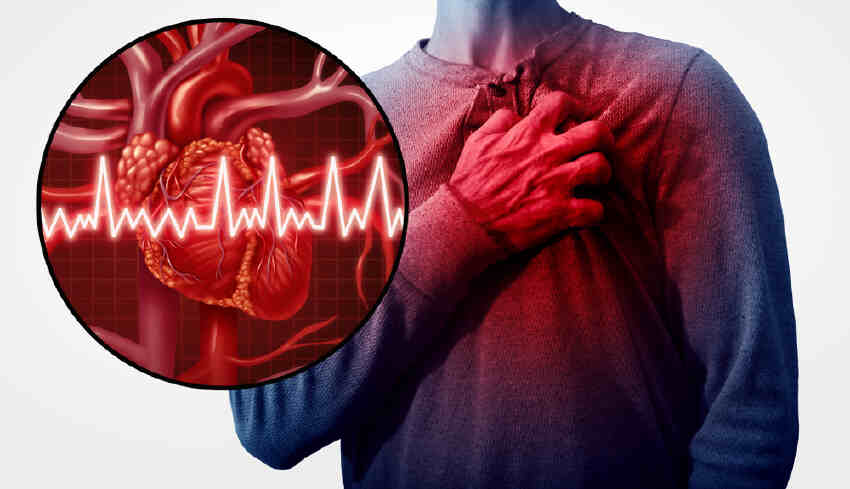 What is Myocardial Infarction Disease